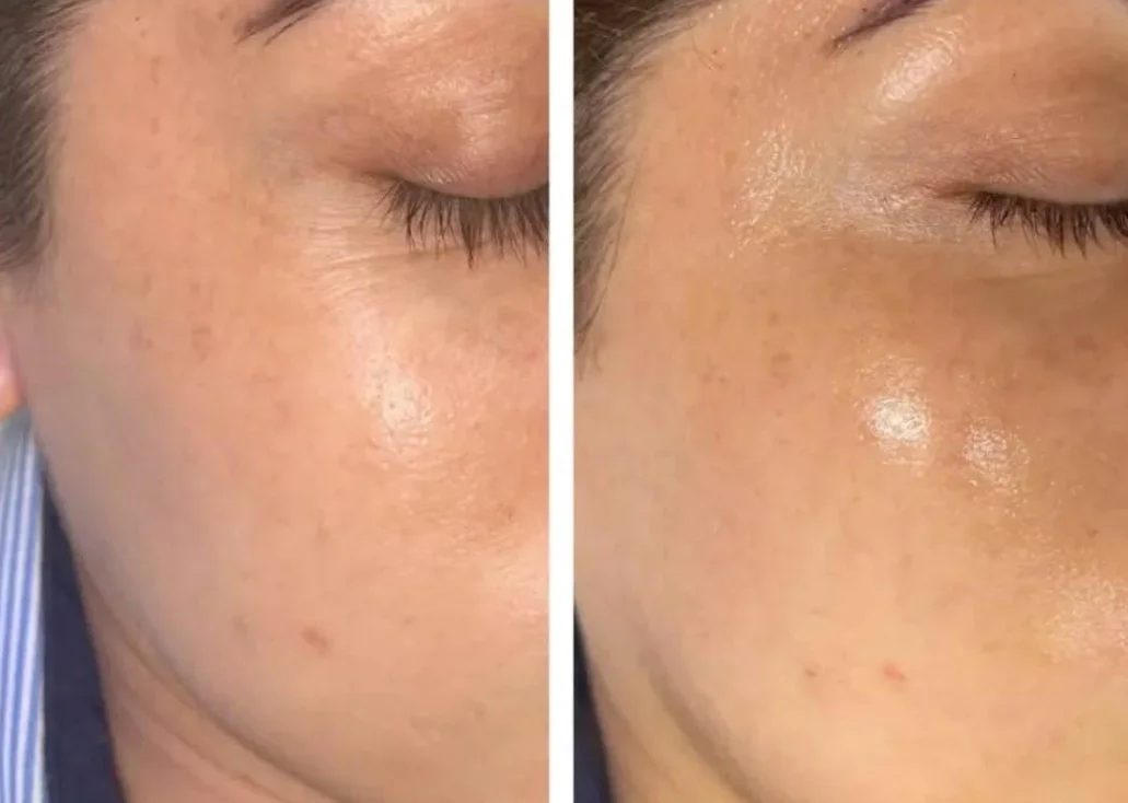 Glowing skin after a facial at Urban Beauty
