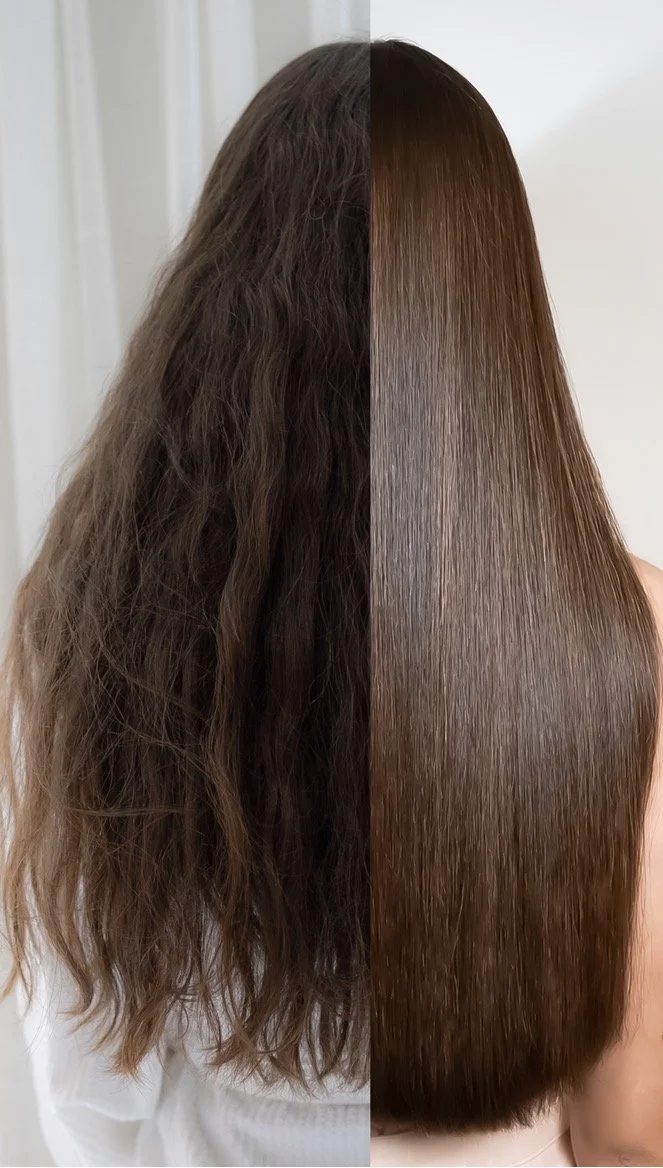 Before and after a Brazilian smoothing treatment
